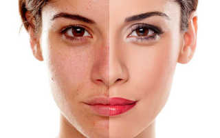 База под макияж для жирной кожи