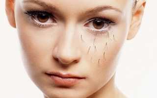 Неправильный рост ресниц после ношения накладных ресниц