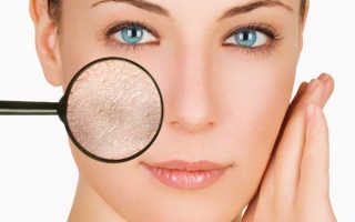 Правильный уход за очень сухой кожей лица: в домашних условиях, в салоне, комплексная программа ухода, лучшие уходовые средства, причины сухости