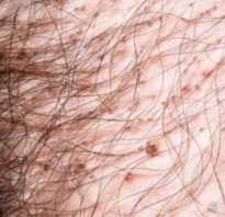 10 вещей, которых вы не знали о лобковых волосах