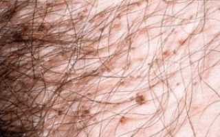 10 вещей, которых вы не знали о лобковых волосах