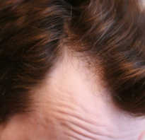 Как отрастить новые волосы после выпадения народные средства