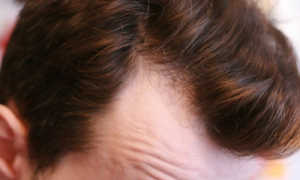 Как отрастить новые волосы после выпадения народные средства