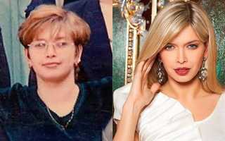 Что у брежневой с глазами