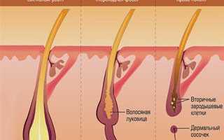 Как скоро можно отрастить длинные пряди? Эксперты отвечают, на сколько см вырастают волосы за год и как ускорить процесс