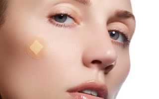 Как предотвратить появление прыщей на лице?