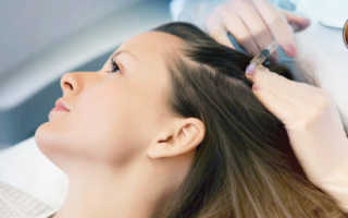 Hair Gain(Хейр Гейн) — Витамины для восстановление роста волос