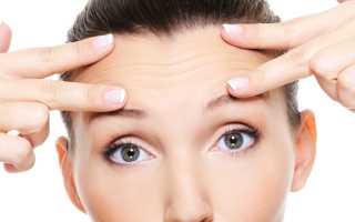 Как эффективно и быстро избавиться от морщин на лбу в домашних условиях и в косметологии