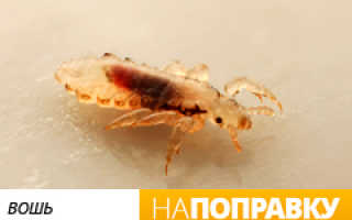 Как быстро вывести вшей: препараты и народные средства